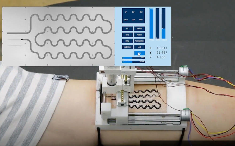 Fabricate flexible electronics directly on your skin with the BodyPrinter
