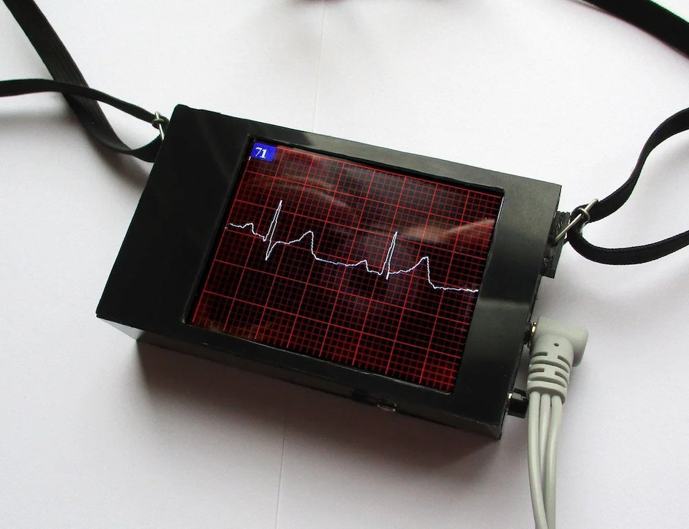 An Arduino ECG device with an integrated display