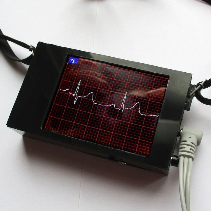 An Arduino ECG device with an integrated display