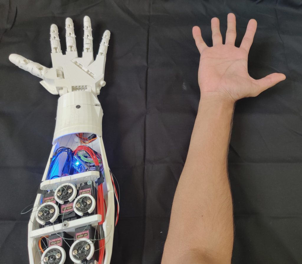 Designing a 3D-printed EMG bionic hand as a low-cost alternative to prosthetic limbs